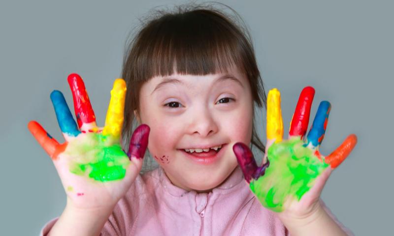 Criança com síndrome de Down