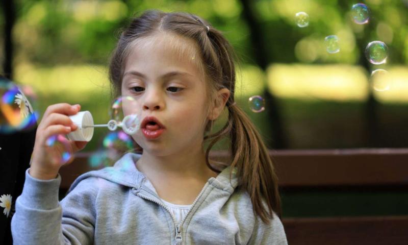 Menina com sindrome dedown
